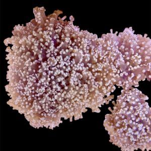 Euphyllia Yaeyamaensis orange metallic XL, WYSIWYG